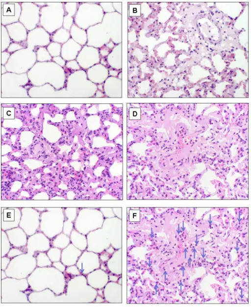 Febrile Non-hemolytic Transfusion Reaction