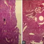 Functional Endometrial Disorders