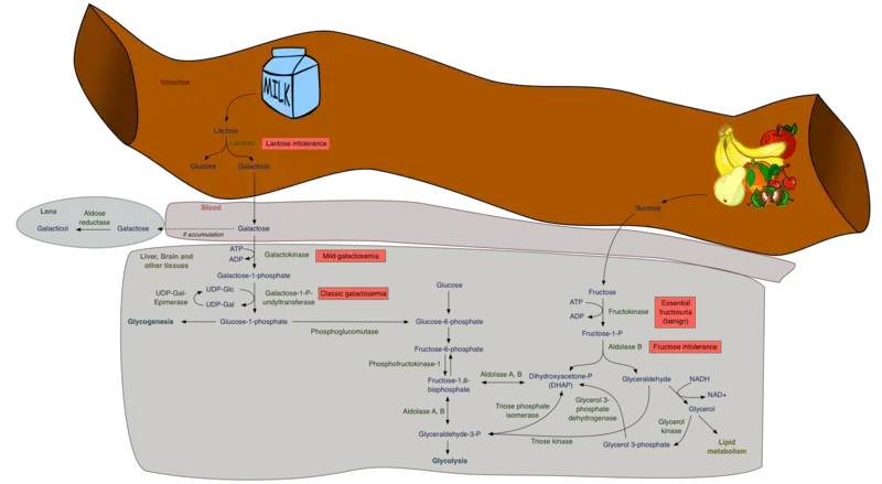 Galactosemia