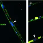 Growths and Receptors Factor