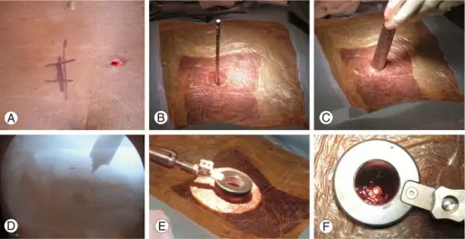 Gunshot Wound Injuries