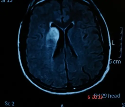 HEMODYNAMIC DISORDERS