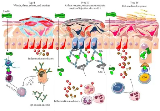 HYPERSENSITIVITY REACTIONS