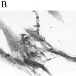 Haemophilus Ducreyi