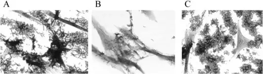 Haemophilus Ducreyi