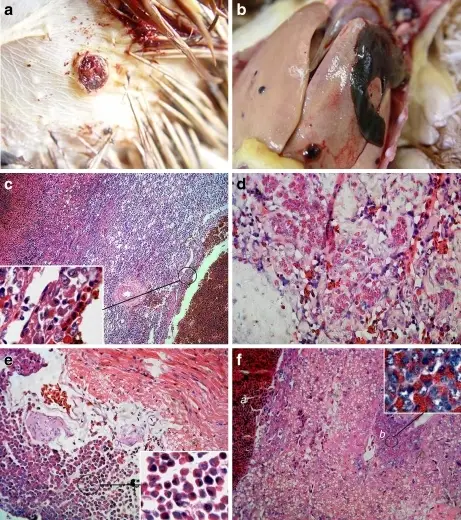 Hemangiomas