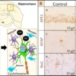 How do Microglia React to Injury