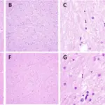 Human Immunodeficiency Virus