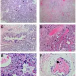 INFECTIOUS DISEASES