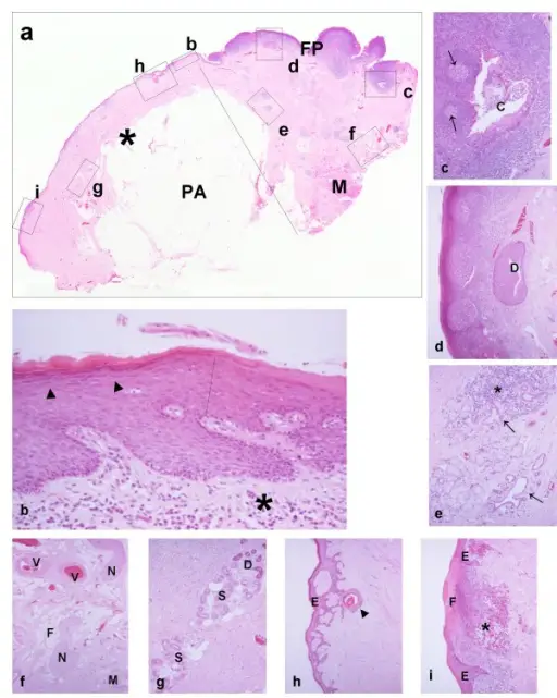 INFLAMMATION