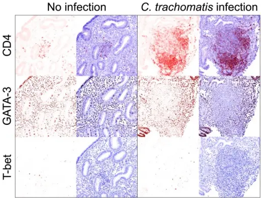 Infections Involving the Upper and Lower Genital Tract