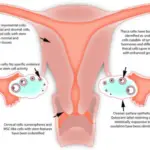 Infections of the Female Genital System