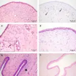 Infections of the Lower Genital Tract