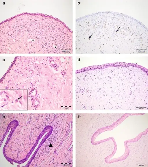 Infections of the Lower Genital Tract