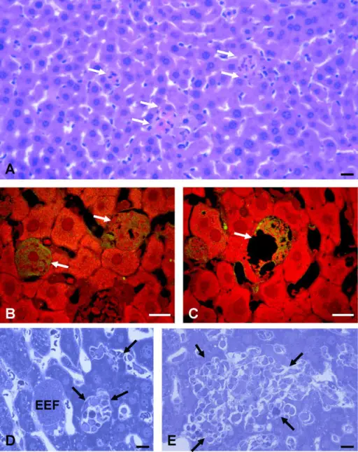 Infectious Disorders of the Liver