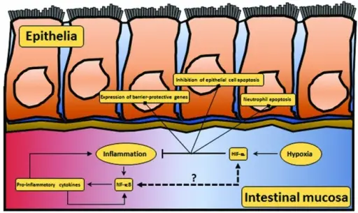 Inflammatory Bowel Disease