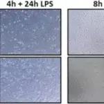 Inflammatory Responses to Infection