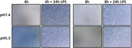 Inflammatory Responses to Infection