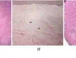 Inflammatory and Reactive Lesions of the Oral Cavity