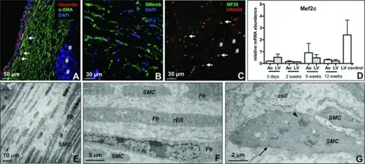 Interactions with the Extracellular Matrix