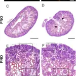 Isolated Glomerular Abnormalities