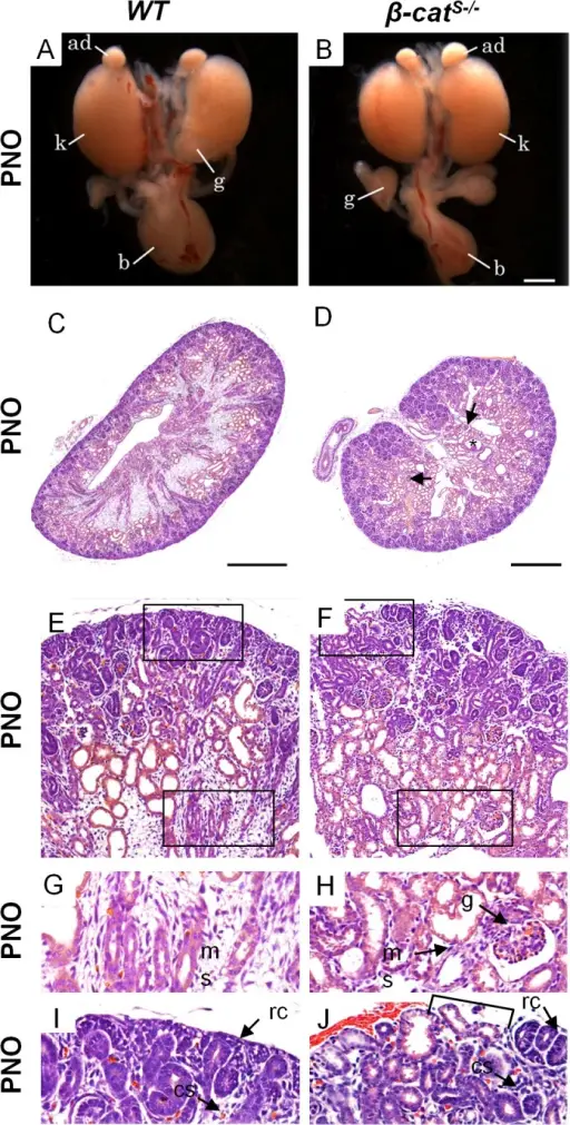 Isolated Glomerular Abnormalities