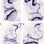 JOINT PATHOLOGY