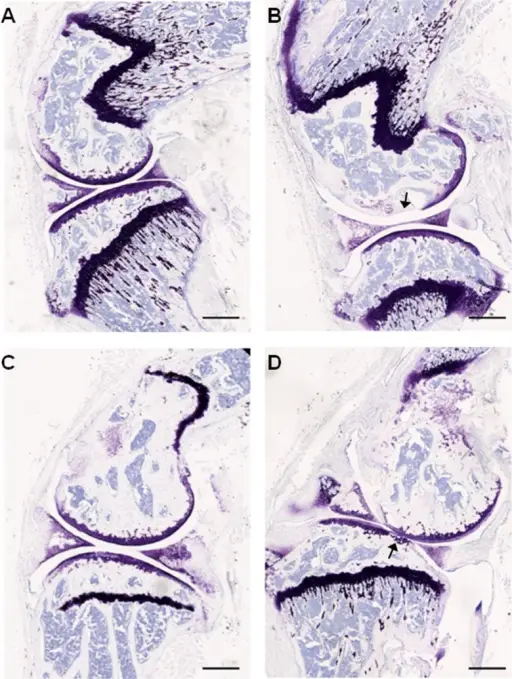 JOINT PATHOLOGY