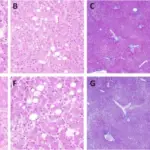 LIVER PATHOLOGY