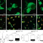 LYSOSOMAL STORAGE DISEASES