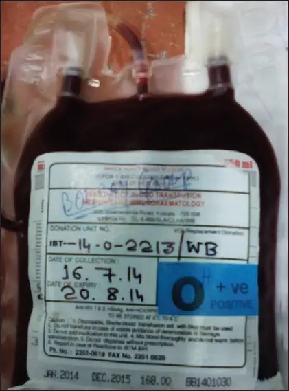 Large Volume Transfusion Related Disorder of Hemostasis