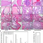 MALE GENITAL SYSTEM PATHOLOGY