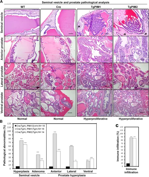 MALE GENITAL SYSTEM PATHOLOGY