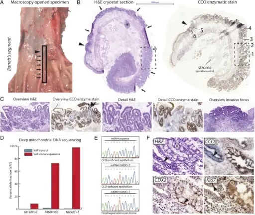 METAPLASIA