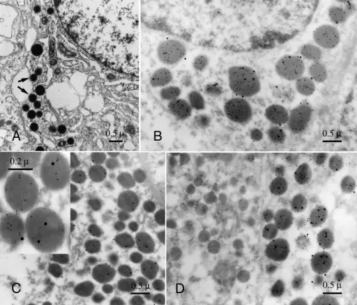 Mammosomatotroph Adenomas