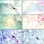 Mechanism of Allograft Rejection