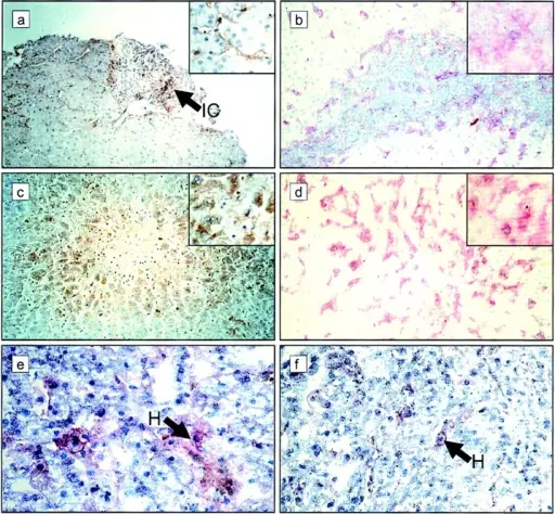 Mechanism of Allograft Rejection