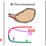 Menopausal Hormonal Therapy Injury