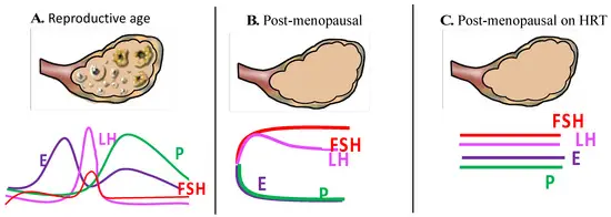 Menopausal Hormonal Therapy Injury