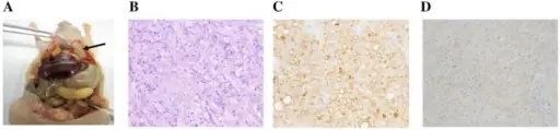 Mesotheliomas