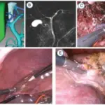 Method to Increase Organ Transplant Life