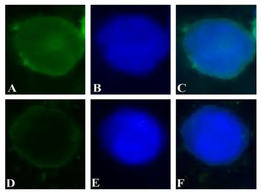 MicroRna