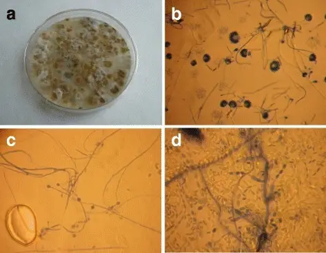 Mold Fungal Infections