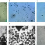 Mycobacteria Bacterial Infections