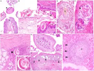 Necrotizing Lesions of the Nose and Upper Airways