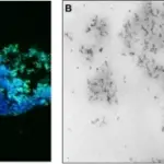 Neisseria Gonorrhoea