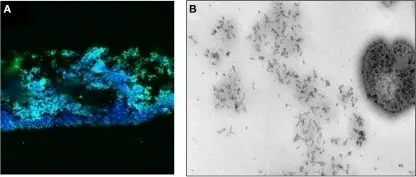 Neisseria Gonorrhoea