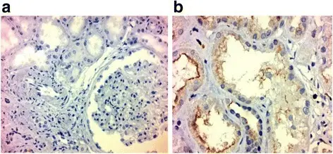 Nephrosclerosis