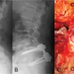 Neurogenic Shock