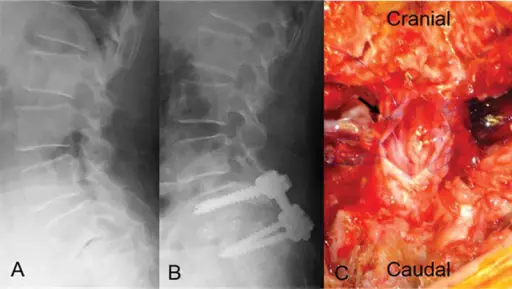 Neurogenic Shock